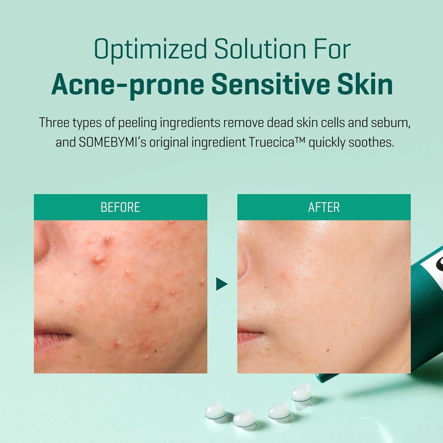 Some By Mi Super Miracle Spot Cream – Intensive Care for Spots & Acne – 30ml